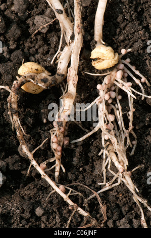 Noduli root con Rhizobium batteri sulle radici di un pisello (Pisum sativum). Foto Stock