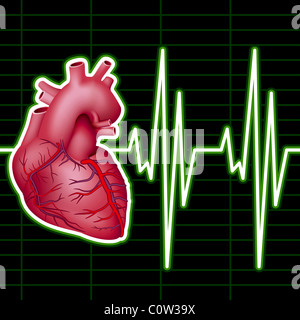 Monitor di cardiologia Foto Stock