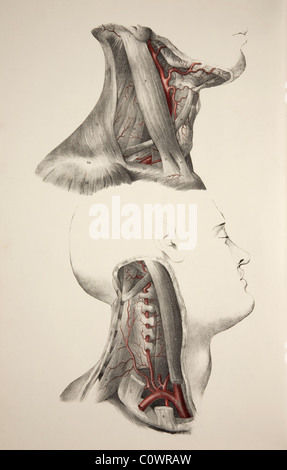 Le arterie del collo. Illustrazione storico che mostra due immagini di testa umana con dissezionati colli rivelando le arterie del collo. Foto Stock