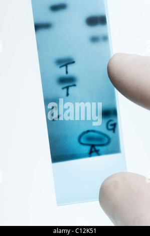 Il sequenziamento del DNA. Scienziato punti a bande che rappresentano le basi nucleotidiche (A,C,T,G) in un'immagine a raggi x di un gel. Metodo Sanger. Foto Stock