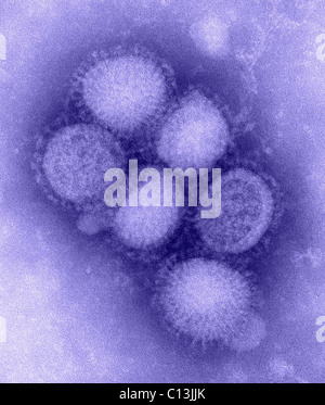 Influenza suina virus. Negativo trasmissione macchiata electron microfotografia. Foto di C. S. orafo e A. Balish, 2009. Foto Stock