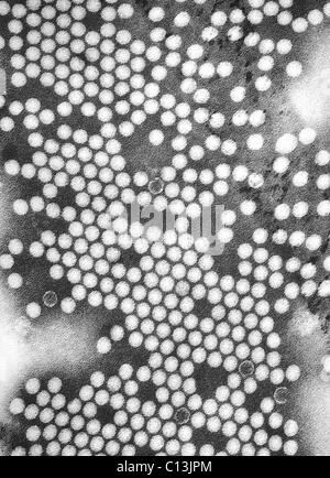 Micrografia elettronica di poliovirus. 1975. Foto Stock