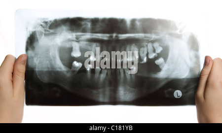 L uomo è in possesso di roentgen foto di denti Foto Stock