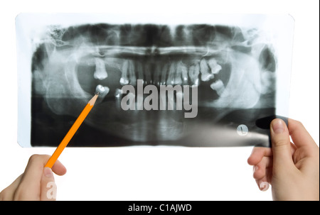 L uomo è in possesso di roentgen foto di denti Foto Stock