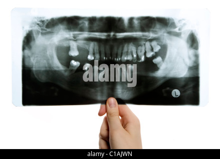 L uomo è in possesso di roentgen foto di denti Foto Stock