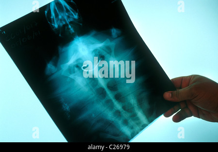 X-ray di tartarughe Caretta ferito da un fishhook a C.R.A.M. Laboratorio .Premia de Mar. provincia di Barcellona . La Catalogna. Spagna. Foto Stock