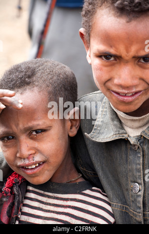 I bambini del villaggio da Simien Mountains dell Etiopia Foto Stock