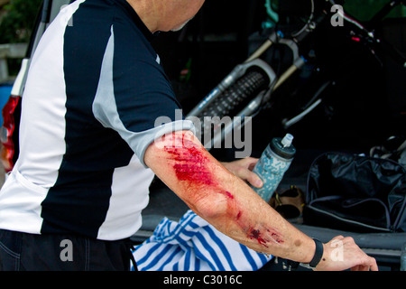 Una mountain bike rider tende a sue lesioni dopo un crash. Foto Stock