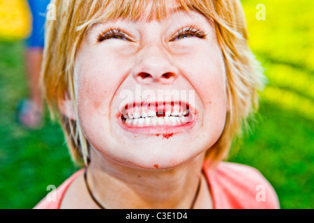 Ragazzo in mostra il dente mancante Foto Stock