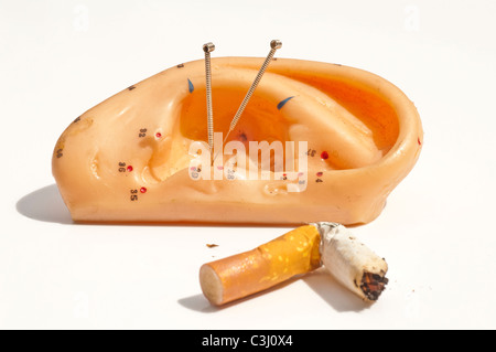 Agopuntura per smettere di fumare Foto Stock