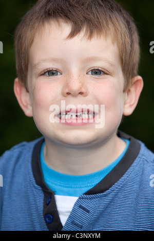 Un ragazzo si mette in mostra la sua mancante dente anteriore. Foto Stock
