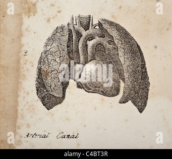 Illustrazione del canale arterioso Foto Stock