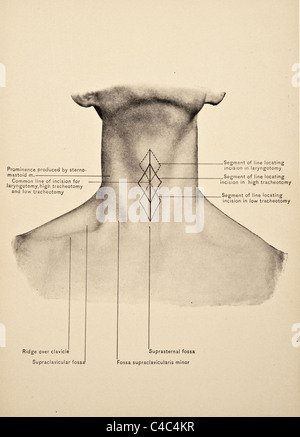 Illustrazione del collo umano copyright 1904 Foto Stock