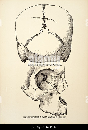 Illustrazione del teschio umano copyright 1904 Foto Stock