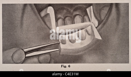 Illustrazione di antiquariato di strumenti chirurgici e apparecchiature mediche Foto Stock