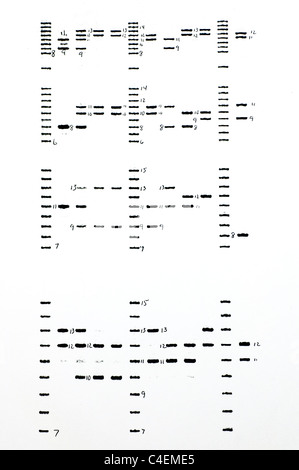 DNA forense risultati con analisi STR di campioni. Foto Stock