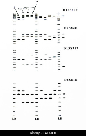 DNA forense risultati con analisi STR di campioni. Foto Stock