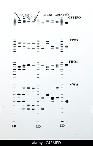 DNA forense risultati con analisi STR di campioni. Foto Stock