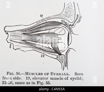 Antica Illustrazione medica della malattia oculare e chirurgia oftalmologici Foto Stock