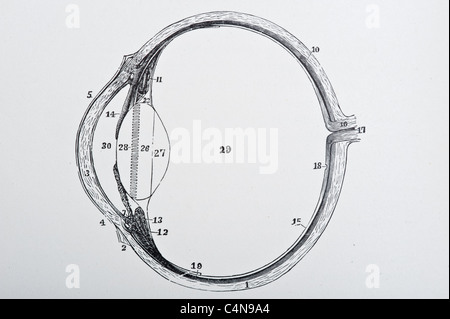 Antica Illustrazione medica della malattia oculare e chirurgia oftalmologici Foto Stock
