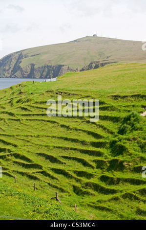 Erosione del terreno in pendenza sulla isola di Unst da uso regolare da pecora. Isole Shetland. SCO 7475 Foto Stock