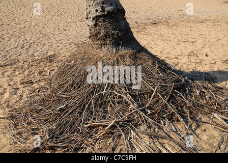 Esposto il sistema di radice di un albero di cocco palm nella sabbia dopo il ciclone yasi, radicale bay, Magnetic Island, Queensland, Australia Foto Stock