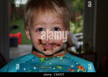 Riacquistato appetito dopo aver varicella Foto Stock