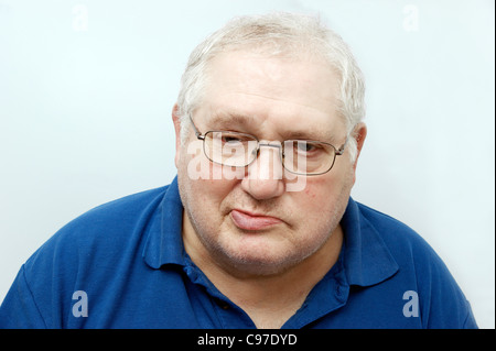 Uomo anziano soffre di Bell paralisi del Foto Stock