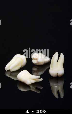 Dente di saggezza su sfondo nero Foto Stock