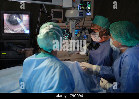 La chirurgia oculare - La rimozione della cataratta operazione Foto Stock