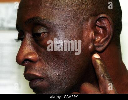 Mar 15, 2003 - Huntsville, AL, USA - ogni uomo in Alabama sistema carcerario noto per avere l AIDS è confinata a un convertito vecchio magazzino con alta, leaky soffitti e letti a castello così vicini che favoriscono l'infezione tra affetti da AIDS, condannati a calcare correzionali Facility. Più th Foto Stock