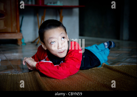 Giovane ragazzo vietnamita diagnosticato come paralisi cerebrale (CP) paziente, il risultato di una perdita di ossigeno immediatamente prima / durante la nascita. Foto Stock