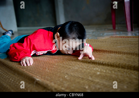 Giovane ragazzo vietnamita diagnosticato come paralisi cerebrale (CP) paziente, il risultato di una perdita di ossigeno immediatamente prima / durante la nascita. Foto Stock