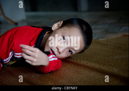 Giovane ragazzo vietnamita diagnosticato come paralisi cerebrale (CP) paziente, il risultato di una perdita di ossigeno immediatamente prima / durante la nascita. Foto Stock