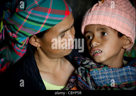 Ritratto di una madre dalla H'MONGS minoranza etnica in Vietnam con il suo bambino, una paralisi cerebrale (CP) del paziente. Foto Stock