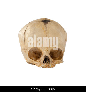 Cranio da una piena espressione umana feto infantile cranio 9 mesi mostrano spot morbido flessibile di sutura e fontanelle Foto Stock