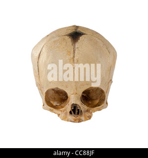 Cranio da una piena espressione umana feto infantile cranio 9 mesi mostrano spot morbido flessibile di sutura e fontanelle Foto Stock