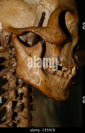 Close up vista laterale originale di scheletro umano in laboratorio medico Foto Stock