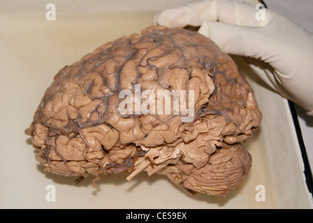 Originale del cervello umano esaminando con mano (utilizzando guanti) dai medici. Foto Stock