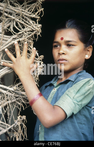 Hexadactilly ; ragazza indiana con sei dita in mano ; malformazione congenita ; Polidattilia ; polidattilismo ; iperdattilia ; India ; Asia Foto Stock