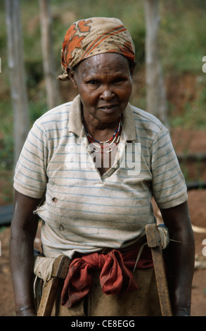 Anziana donna tutsi che ha perso la gamba per il diabete nelle zone rurali del Ruanda, Africa Foto Stock