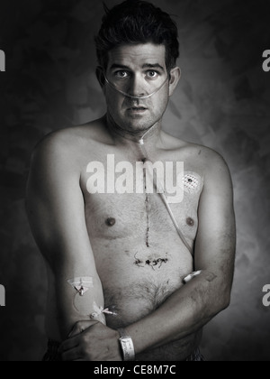 L'uomo recuperando da operazione cuore cabg byepass Foto Stock