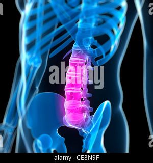 Dolore alla schiena, concettuale computer grafica. Foto Stock