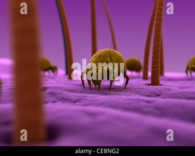 Gli acari della polvere. Computer artwork di acari della polvere (Dermatophagoides pteronyssinus) sulla pelle umana. Foto Stock