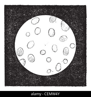 Fig. 2. le cellule bianche del sangue o i leucociti, vintage illustrazioni incise. dizionario di parole e le cose - larive e fleury - 1895. Foto Stock
