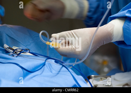 Close-up di un infermiere la mano che regge una apparecchiatura medicale in una sala operatoria Foto Stock