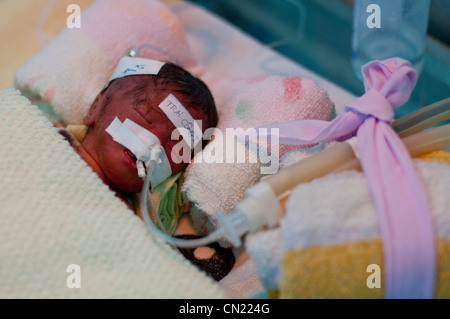 Prenatale di ICU Ward, Danang, Vietnam Foto Stock