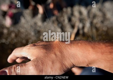 Gancio di pesce tirando la pelle Foto Stock