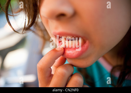 Ragazza toccando dente allentato Foto Stock