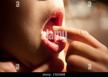 Ragazza toccando dente allentato con il dito indice Foto Stock